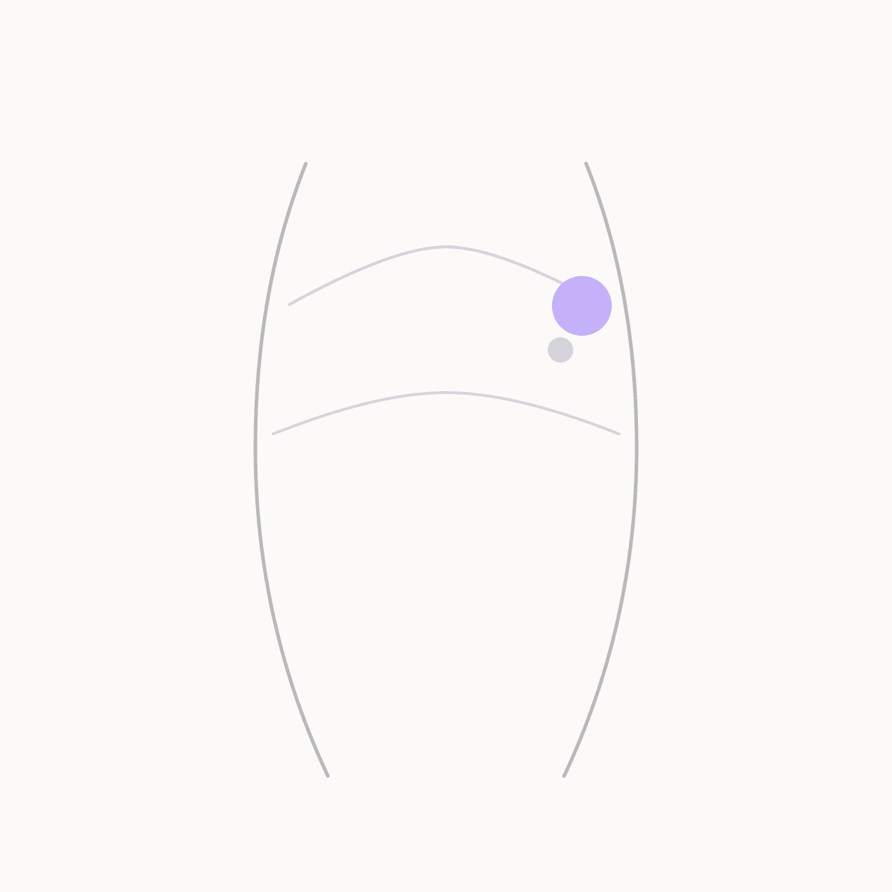 Anatomical locator illustration showing TW-14 Jianliao